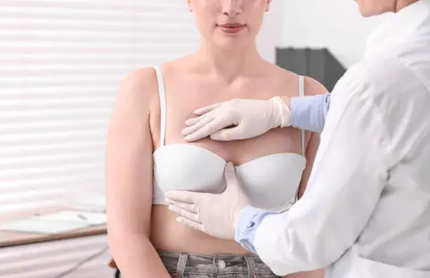 Recambio o retiro de implantes mamarios — Perfect by Dr. Orsini, Caracas