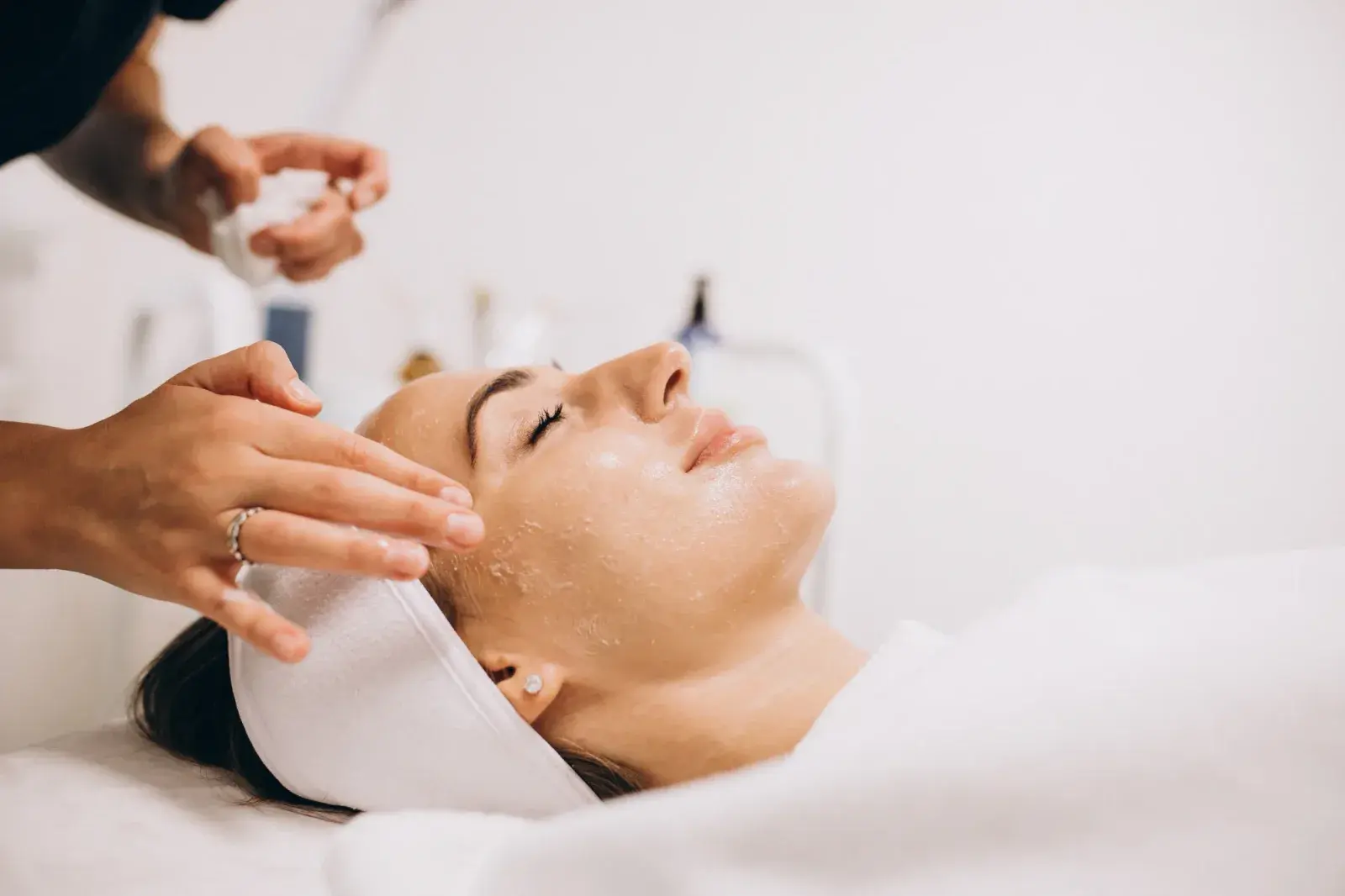 Peeling Facial — atención estética en Caracas