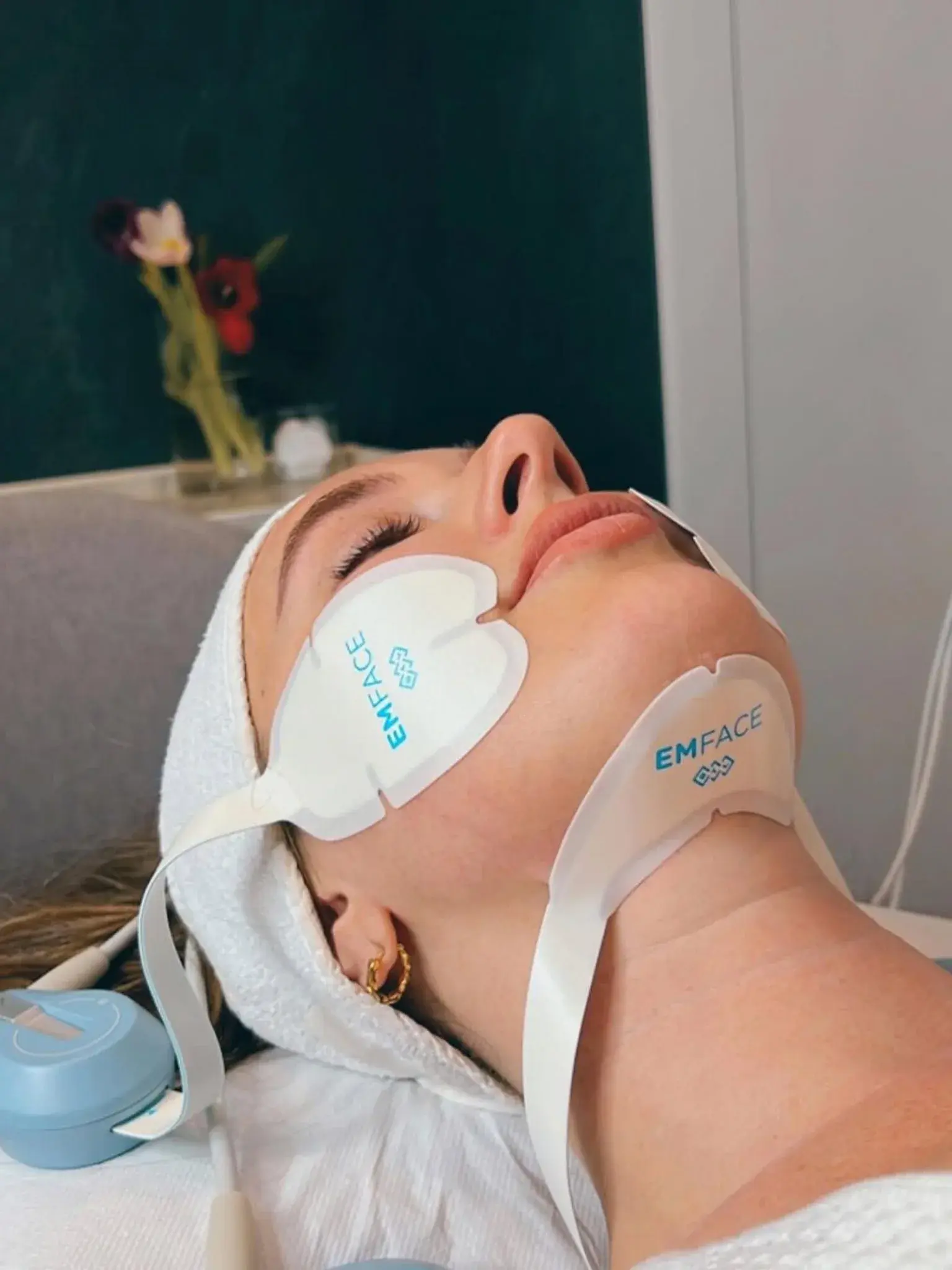 EmFace: lifting facial sin agujas — atención estética en Caracas